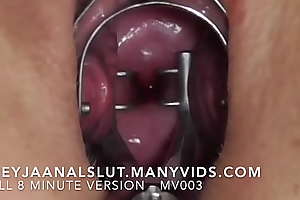 Crude FreyjaAnalslut : Cervical Spreading - Opening Freyja's cunt showing you her tight cervix, and then opening Freyja's cervix with a speculum - Vigorous version on ManyVids